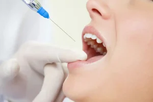 How Botox Reshapes Dentists' Approach to Treating Orofacial Muscle Disorders